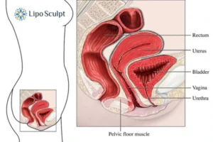 Treatment For A Leaky Bladder 2 How EM Chair treatment Stoke on Trent can help Leaky bladder issues. Read more now!