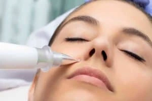 Best Actinic Keratoses Removal 3 Actinic keratoses Stoke on Trent solutions - book in today!